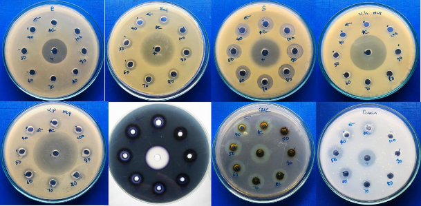 Hình 4 7 Khả năng kháng các chủng vi khuẩn kiểm định của chủng N1 4 trên 1