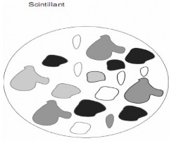 Hình 3 6 Vệt đốm và kích thước trung bình miệng thu 3 5 Yếu tố ảnh hưởng 10