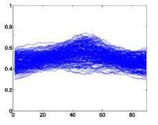 Rung thất – I Ngoại tâm thu thất V Hình 4 1 Hình dáng mẫu phức bộ QRS của 5
