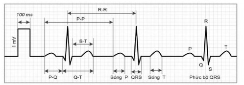Hình 1 2 Hình dáng và thành phần chính của tín hiệu điện tim ECG Thông qua tín 2