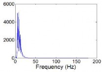 a b Hình 3 4 Phân bố phổ năng lượng của tín hiệu ECG gốc a kết quả sau 15
