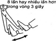 Lưu ý ở một vài kiểu xe ngày nay mã chẩn đoán được xóa bằng cách đạp 21