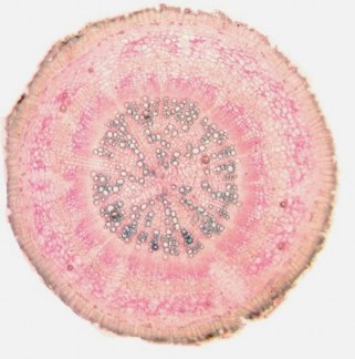 Toàn thân Đinh lăng Vùng gỗ Túi tiết ly bào Tia gỗ Lông hút Lớp bần Hình 4 15 1