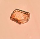 Khối nhựa mang màu Mảnh mô mềm Hình 4 17 Soi bột lá Đinh lăng vật kính 40X Soi 11