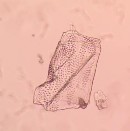 Hình 4 17 Soi bột lá Đinh lăng vật kính 40X Soi bột thân Đinh lăng Tiến hành theo 13