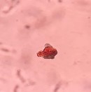 Khối nhựa mang màu Mảnh mô mềm Mạch mạng Mạch xoắn Lông đa bào Mạch điểm 15