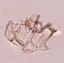 Mảnh mô mềm Mạch mạng Mạch xoắn Lông đa bào Mạch điểm Lông đơn bào Khối 16