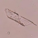 Mạch xoắn Lông đa bào Mạch điểm Lông đơn bào Khối tinh bột Hình 4 19 Soi 18