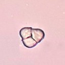 Khối tinh bột Hình 4 19 Soi bột thân Đinh lăng vật kính 40X Soi bột rễ Đinh 22