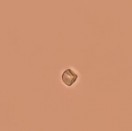 Hình 4 19 Soi bột thân Đinh lăng vật kính 40X Soi bột rễ Đinh lăng Tiến hành 23