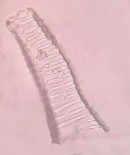 Mạch mạng Mạch xoắn Mạch điểm Sợi kèm tinh thể Mảnh mô mềm Hạt tinh bột 25