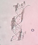 Mạch xoắn Mạch điểm Sợi kèm tinh thể Mảnh mô mềm Hạt tinh bột Bó sợi 26