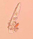 Sợi kèm tinh thể Mảnh mô mềm Hạt tinh bột Bó sợi Sợi mô cứng Mạch vạch 28