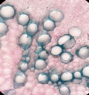 Túi tiết ly bào Tia gỗ Lông hút Lớp bần Hình 4 15 Vi phẫu rễ Đinh lăng vật 3