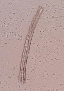 Bó sợi Sợi mô cứng Mạch vạch Hình 4 21 Soi bột rễ Đinh lăng vật kính 40X Soi 31