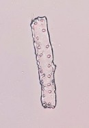 Sợi mô cứng Mạch vạch Hình 4 21 Soi bột rễ Đinh lăng vật kính 40X Soi dưới 32