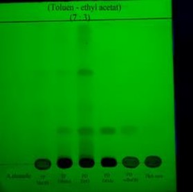 Soi UV 254 nm Soi UV 365 nm Sau khi nhúng TT Acid sulfuric 10 Hình 4 23 Định tính cao 5