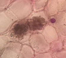 Bần Tinh thể cacli oxalat hình cầu gai Bần Mô mềm vỏ Libe 2 Gỗ 2 Tia tủy Mô 14