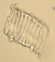 Mạch vạch Mạch mạng Mạch điểm Tinh thể cacli oxalat hình khối Hạt tinh bột 16