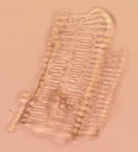 Mạch mạng Mạch điểm Tinh thể cacli oxalat hình khối Hạt tinh bột Hình 4 7 Soi 17