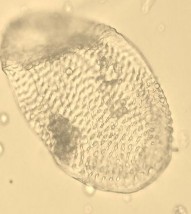 Mạch điểm Tinh thể cacli oxalat hình khối Hạt tinh bột Hình 4 7 Soi bột rễ 18