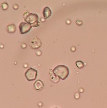 Hạt tinh bột Hình 4 7 Soi bột rễ Đinh Lăng 4 2 THỬ TINH KHIẾT 4 2 1 Độ ẩm 20