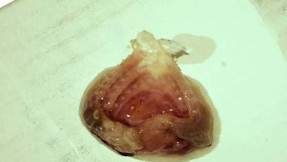 Hình 4 4 Hình dạng lược mang của cá đục Sillago sihama Trên cung mang thứ nhất 2