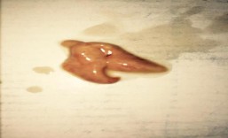 Hình 4 6 Hình dạng gan cá đục Sillago sihama Gan cá đục to nằm ở phần đầu 4