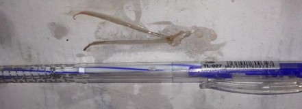 Hình 4 10 Tinh sào giai đoạn II của cá đục Sillago sihama Hình 4 11 Noãn sào giai 7