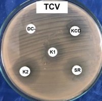 Hình 4 4 Hoạt tính ức chế E coli và S aureus của cây Sói rừng và cây Khoan cân 2