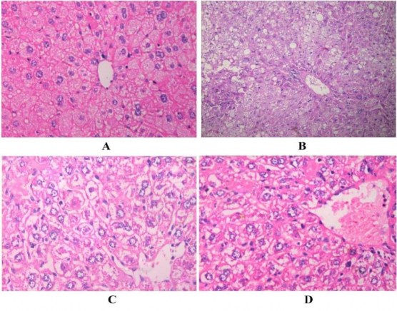 Hình 3 10 Ảnh vi thể tiêu bản đúc cắt gan của chuột vật kính 400 A Gan 1