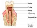 Sơ Đồ Keyes Giải Thích Nguyên Nhân Gây Bệnh Sâu Răng