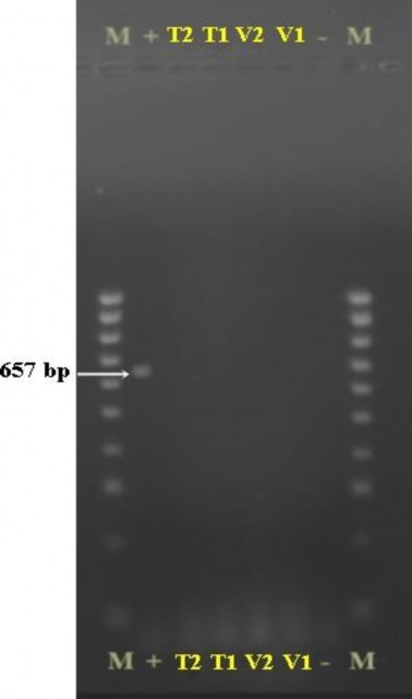Hình 3 37 Kết quả điện di trên gel agarose của các mẫu giống chanh dây tím và 5