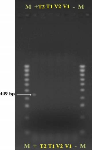 Hình 3 38 Kết quả điện di trên gel agarose của các mẫu giống chanh dây tím và 6