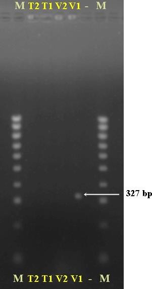 Hình 3 39 Kết quả điện di trên gel agarose của các mẫu giống chanh dây tím và 1