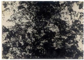 Hình 1 7 Tổ chức tế vi của xoobit tôi Khi giữ austenit quá nguội ở nhiệt độ 7