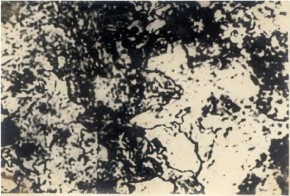 Hình 1 8 Tổ chức tế vi của trôxit tôi Khi giữ austenit quá nguội ở nhiệt độ 8