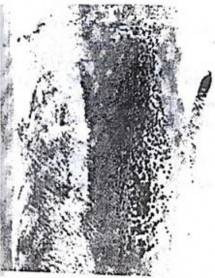 a b Hình 7 12 Ăn m òn mài mòn a Ăn mòn cục bộ do chảy rối của chất lỏng 11