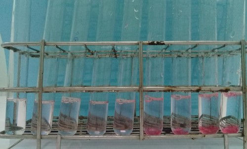 Hình 4 4 Quan sát trực quan sự hình thành gel trong các công thức B1 – B9 – B9 2