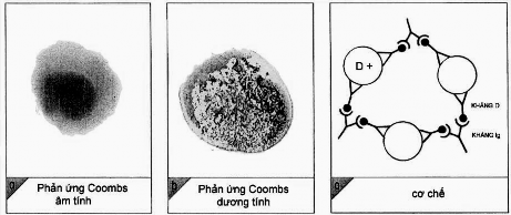 Hình 4 3 Phản ứng Coombs gián tiếp a Hình ảnh phản ứng âm tính b Hình 2