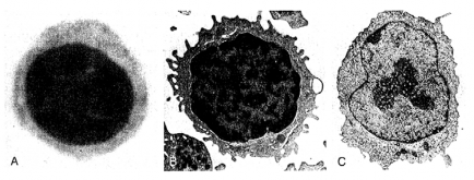 Hình 5 2 Hình thái học lymphô bào A Hình ảnh kính hiển vi quang học của lymphô 1