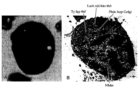 Hình 5 5 Hình thái của tương bào A Hình ảnh kính hiển vi quang học của tương 4