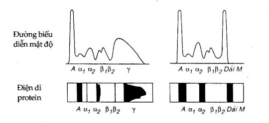 Các dải M có thể định lượng bằng một dụng cụ gọi là mật độ kế 3