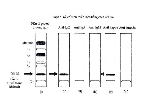 Hình 12 7 Định tính một dải M bằng phương pháp cố định miễn dịch Trong ví 4