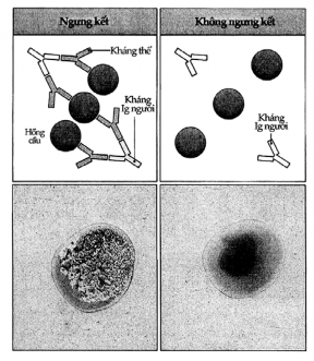 Hình 9 8 Phản ứng Coomb gián tiếp Phản ứng này dùng để phát hiện kháng thể 5