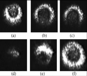 Hình 1 1 Hình ảnh nhiễu xạ khi E H hạt hình cầu từ tính 3µm tán xạ trong 1
