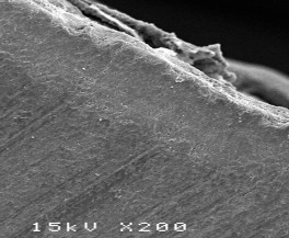 Hình 3 1 Hình ảnh tổn thương hủy khoáng ở độ phóng đại 200 – 500 lần 1