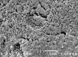 Hình 3 5 Bề mặt răng tương ứng sâu răng D 1 ở độ phóng đại 50 – 3500 lần 10