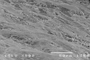 Hình 3 6 Bề mặt răng tương ứng sâu răng D 2 ở độ phóng đại 500 – 2000 11