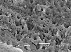 Hình 3 6 Bề mặt răng tương ứng sâu răng D 2 ở độ phóng đại 500 – 2000 12